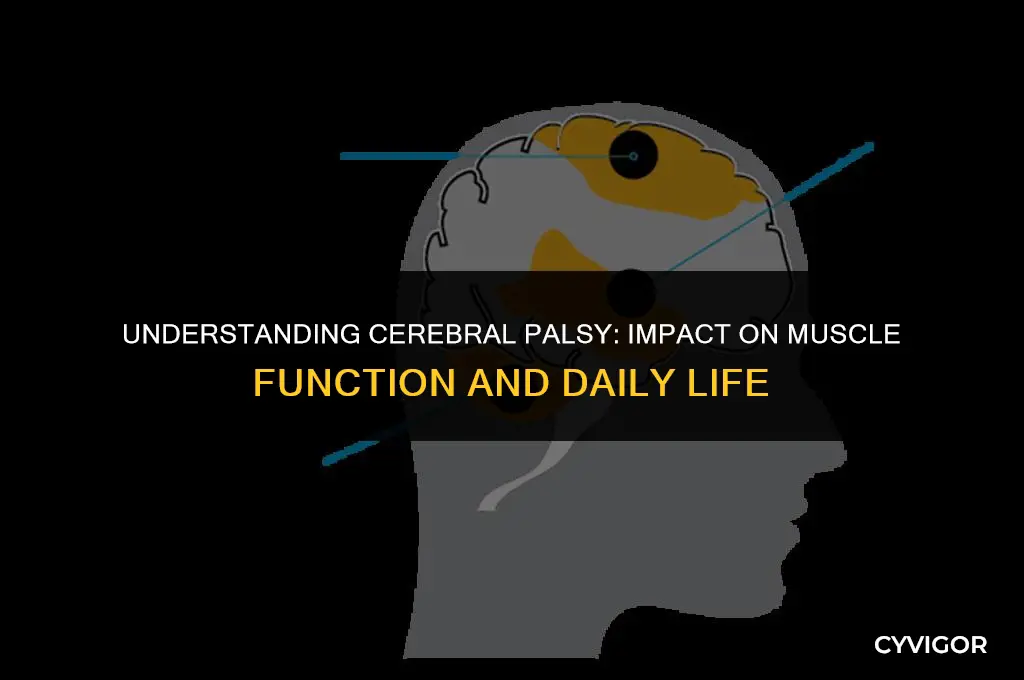 how cerebral palsy affects muscles