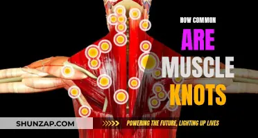 Muscle Knots: A Common Ailment, Explained