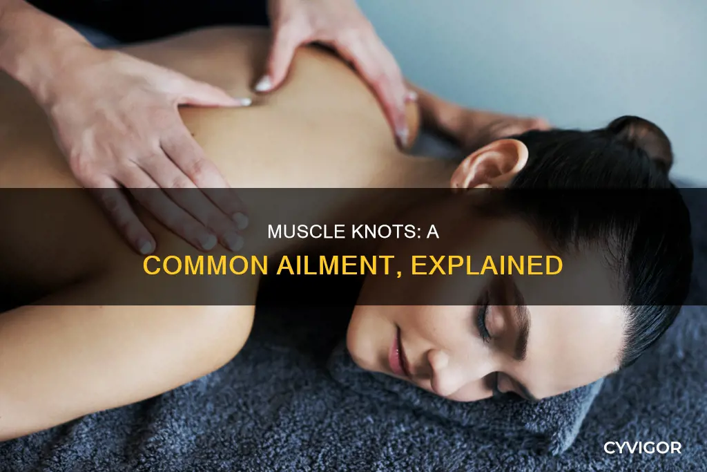 how common are muscle knots