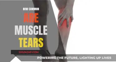 Muscle Tears: A Common Injury, Explained