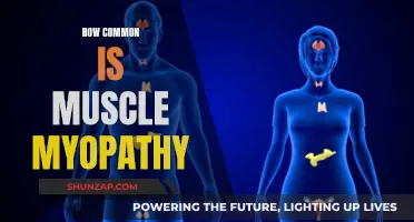Muscle Myopathy: Is It As Rare As You Think?