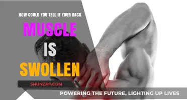 Is Your Back Muscle Swollen? Signs and Symptoms to Look Out For