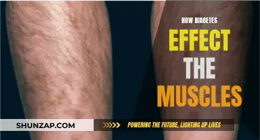 Diabetes and Muscles: Understanding the Impact and Effects
