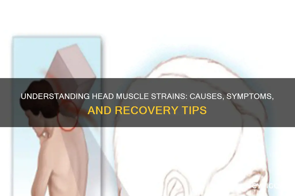 how did i pull a muscle in my head