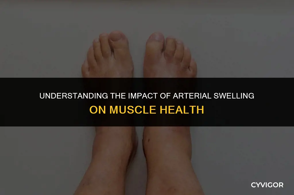 how do arteries swelling affect muscles