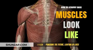 Understanding Atrophy: A Visual Guide to Back Muscle Changes