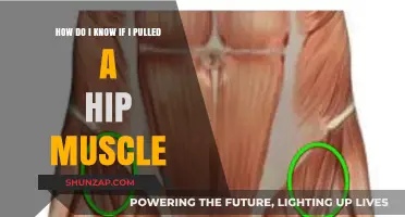 Identifying a Pulled Hip Muscle: Symptoms, Causes, and Next Steps