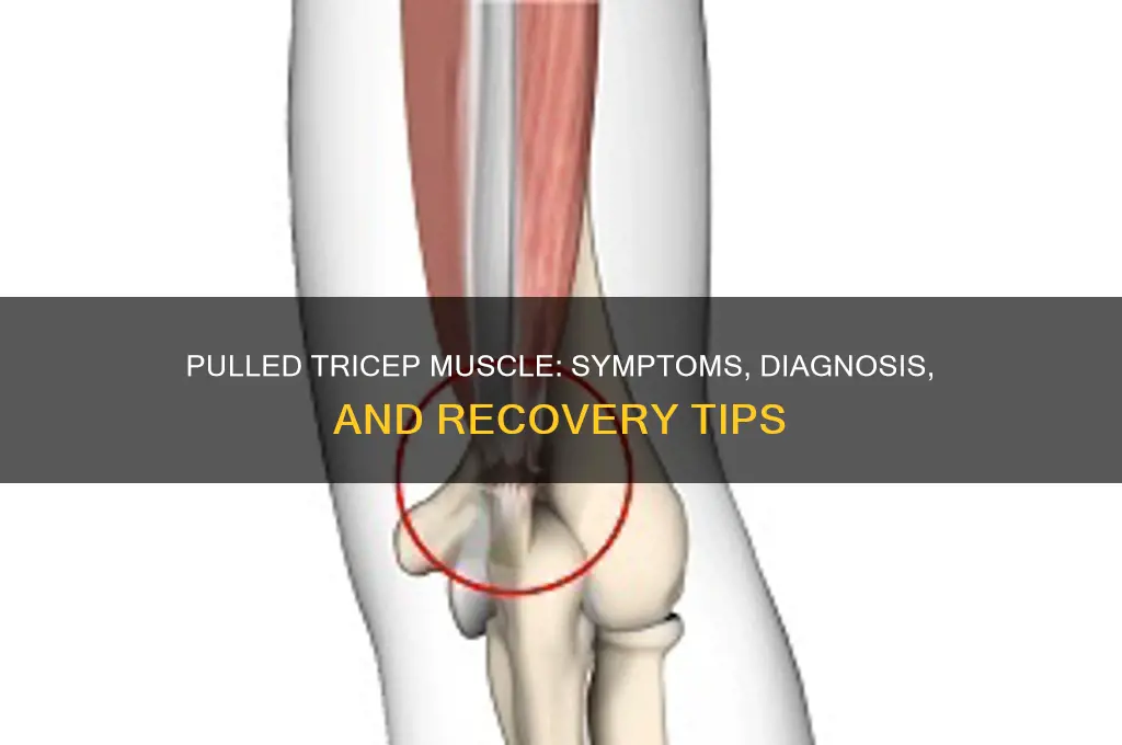 how do i know if i pulled my tricep muscle