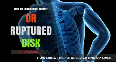 Sore Muscle or Ruptured Disk: Identifying Your Back Pain Cause