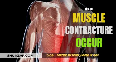 Understanding Muscle Contractures: Causes and Mechanisms