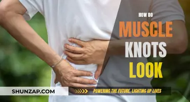 Unraveling Muscle Knots: Understanding Their Appearance and Impact