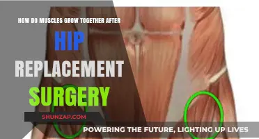 Muscle Recovery and Growth Post-Hip Replacement: A Comprehensive Guide