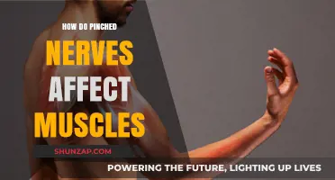 Understanding the Impact of Pinched Nerves on Muscle Health