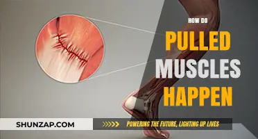 Understanding Pulled Muscles: Causes, Prevention, and Recovery Explained