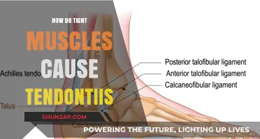 Tight Muscles and Tendons: Understanding the Link to Tendinitis