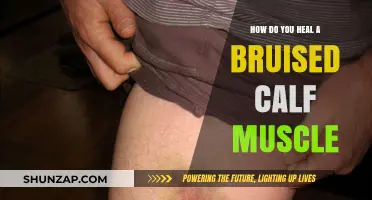 Effective Ways to Heal a Bruised Calf Muscle Quickly