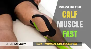 Speedy Recovery: Effective Ways to Heal a Torn Calf Muscle