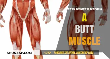 Signs You've Pulled a Butt Muscle: Symptoms and Relief Tips