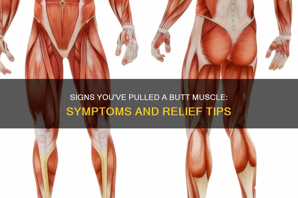 how do you know if you pulled a butt muscle