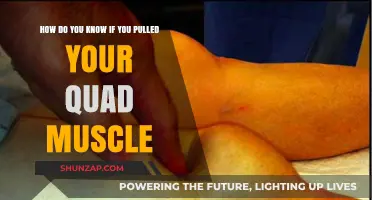 Pulled Quad Muscle: Symptoms, Diagnosis, and Recovery Tips