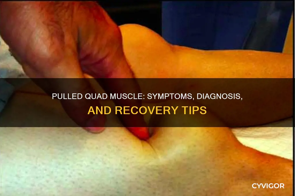 how do you know if you pulled your quad muscle