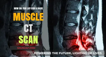 Preparing for a Back Muscle CT Scan: A Step-by-Step Guide
