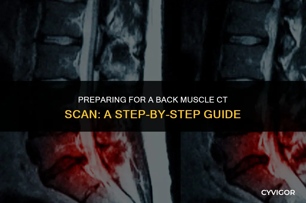 how do you lay for a back muscle ct scan