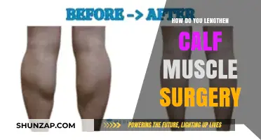 Enhancing Calf Muscle Surgery Recovery: A Comprehensive Guide