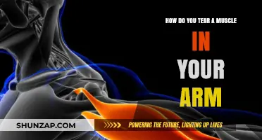 Understanding Arm Muscle Tears: Causes, Symptoms, and Prevention Tips