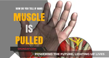 Identifying a Pulled Hand Muscle: Symptoms, Causes, and Quick Relief Tips