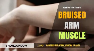 Effective Treatment Tips for Healing a Bruised Arm Muscle Fast