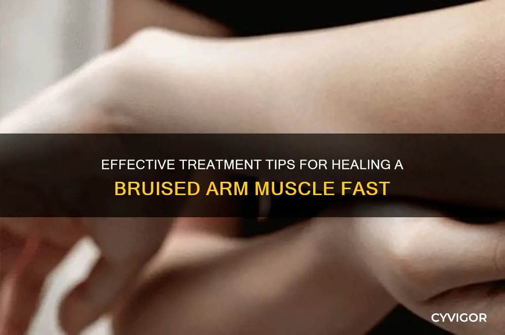 how do you treat a bruised arm muscle