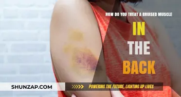 Treating a Bruised Back Muscle: Effective Remedies and Recovery Tips