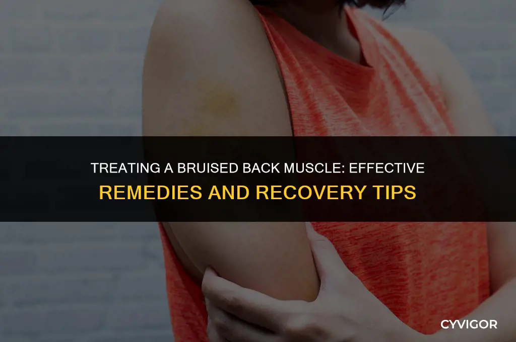 how do you treat a bruised muscle in the back