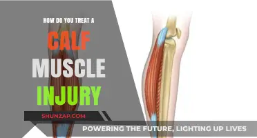 Effective Ways to Treat and Recover from a Calf Muscle Injury