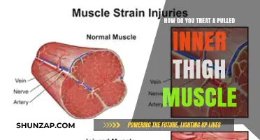 Effective Treatment Strategies for Pulled Inner Thigh Muscle Recovery