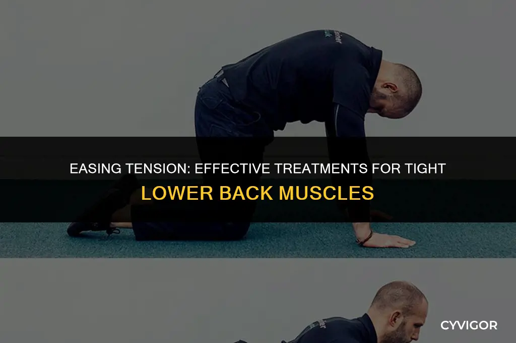how do you treat a tight lower back muscle