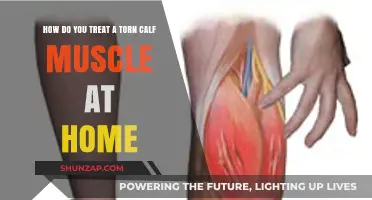 Effective Home Remedies for Treating a Torn Calf Muscle