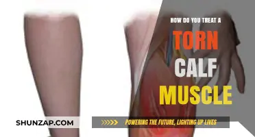 Effective Treatments for a Torn Calf Muscle: A Comprehensive Guide