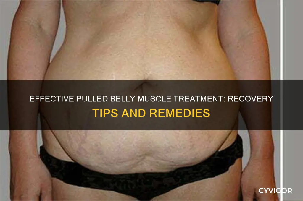 how do you treat pulled belly muscled