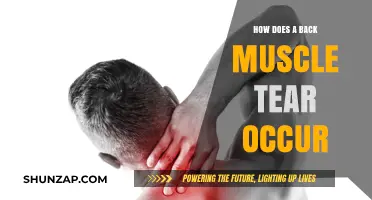 Understanding Back Muscle Tears: Causes, Symptoms, and Prevention