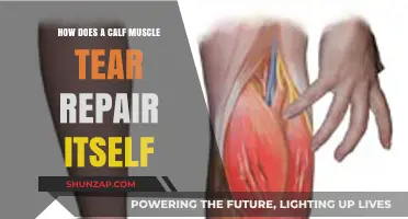 Healing Steps: The Remarkable Recovery of a Calf Muscle Tear