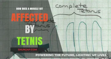Tetanus Impact on Muscles: A Comprehensive Guide
