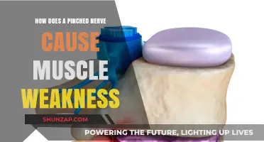 Pinched Nerve: Understanding the Cause of Muscle Weakness