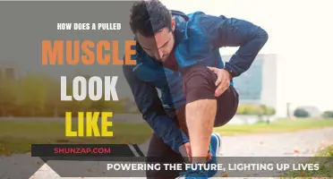 Visual Guide: Identifying a Pulled Muscle and Its Appearance