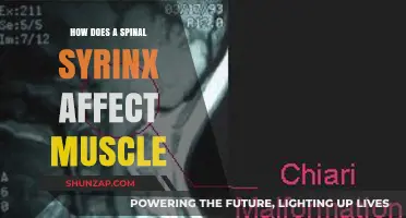 Understanding the Impact of Spinal Syrinx on Muscle Function