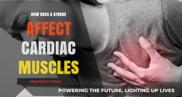 Exploring the Impact of Stroke on Cardiac Muscles: A Comprehensive Guide