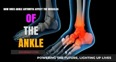 Impact of Ankle Arthritis on Surrounding Muscles: A Comprehensive Guide