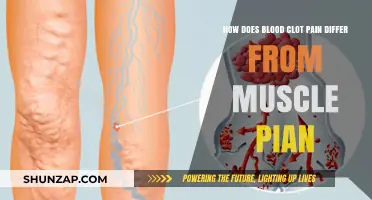 Blood Clot Pain vs. Muscle Pain: Key Differences Explained