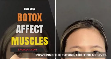 Understanding Botox: How It Affects Muscles and More